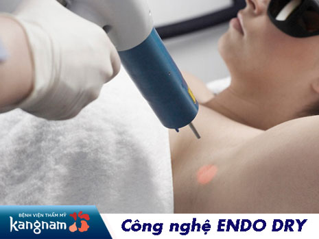 Công nghệ trị hôi nách mới nhất Endo Dry giá bao nhiêu? Có nguy hiểm không?