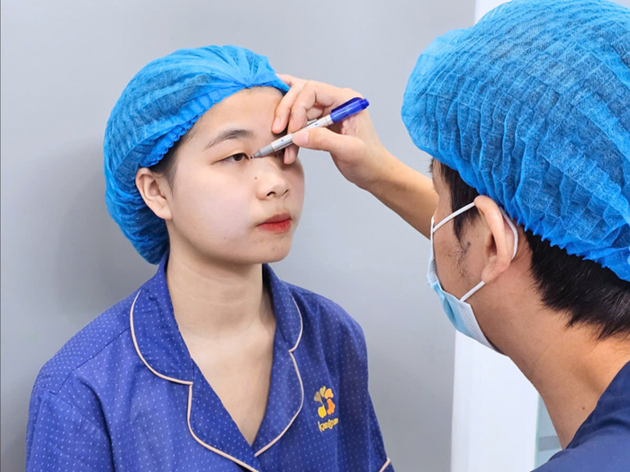 Phẫu Thuật Thẩm Mỹ an toàn, bác sĩ đo vẽ vùng mắt trước khi can thiệp